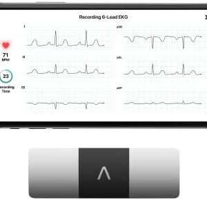 KardiaMobile 6-Lead Personal EKG Monitor – Six Views of The Heart – Detects AFib and Irregular Arrhythmias – Instant Results in 30 Seconds – Works with Most Smartphones - FSA/HSA Eligible